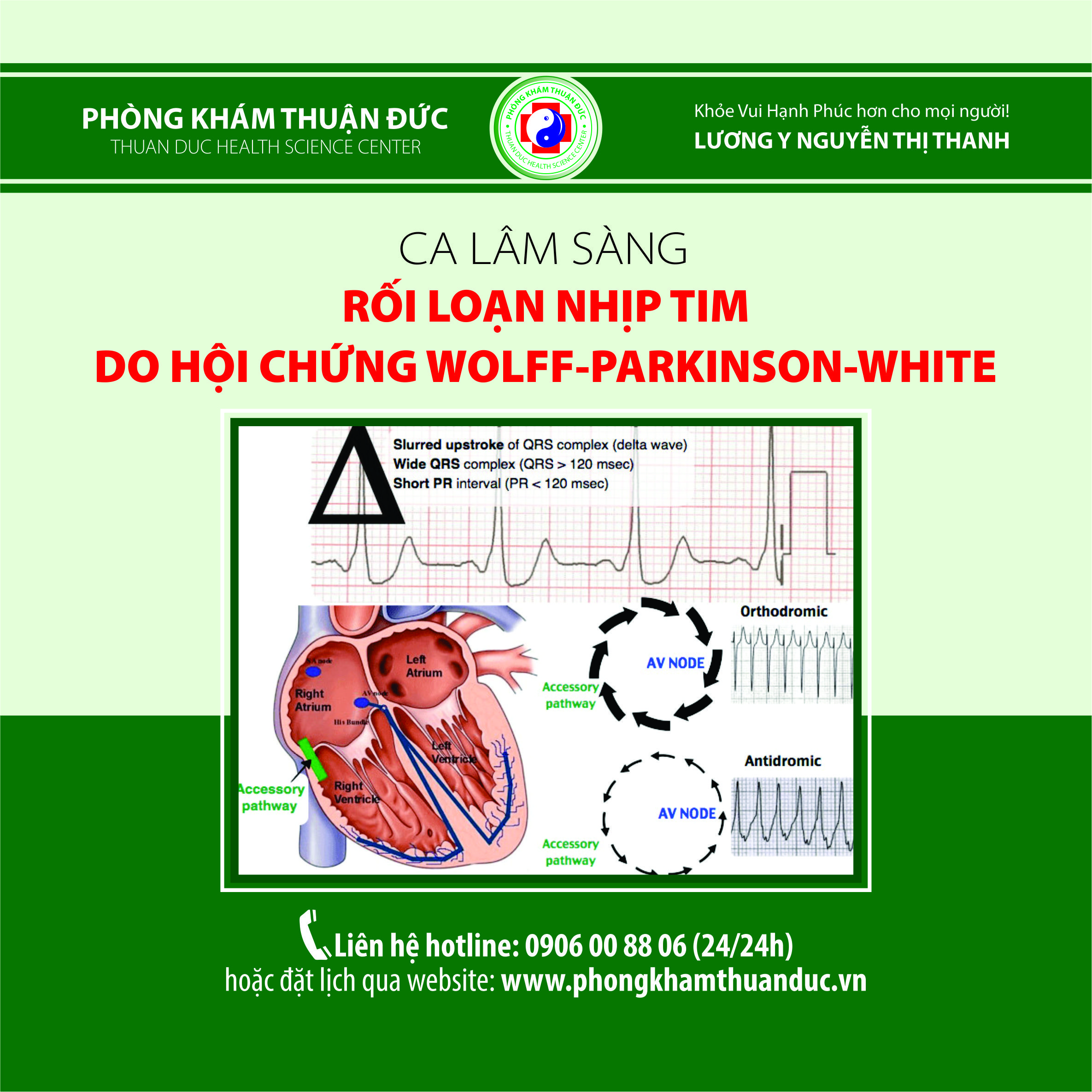 Ca lâm sàng rối loạn nhịp tim do hội chứng Wolff-Parkinson-White