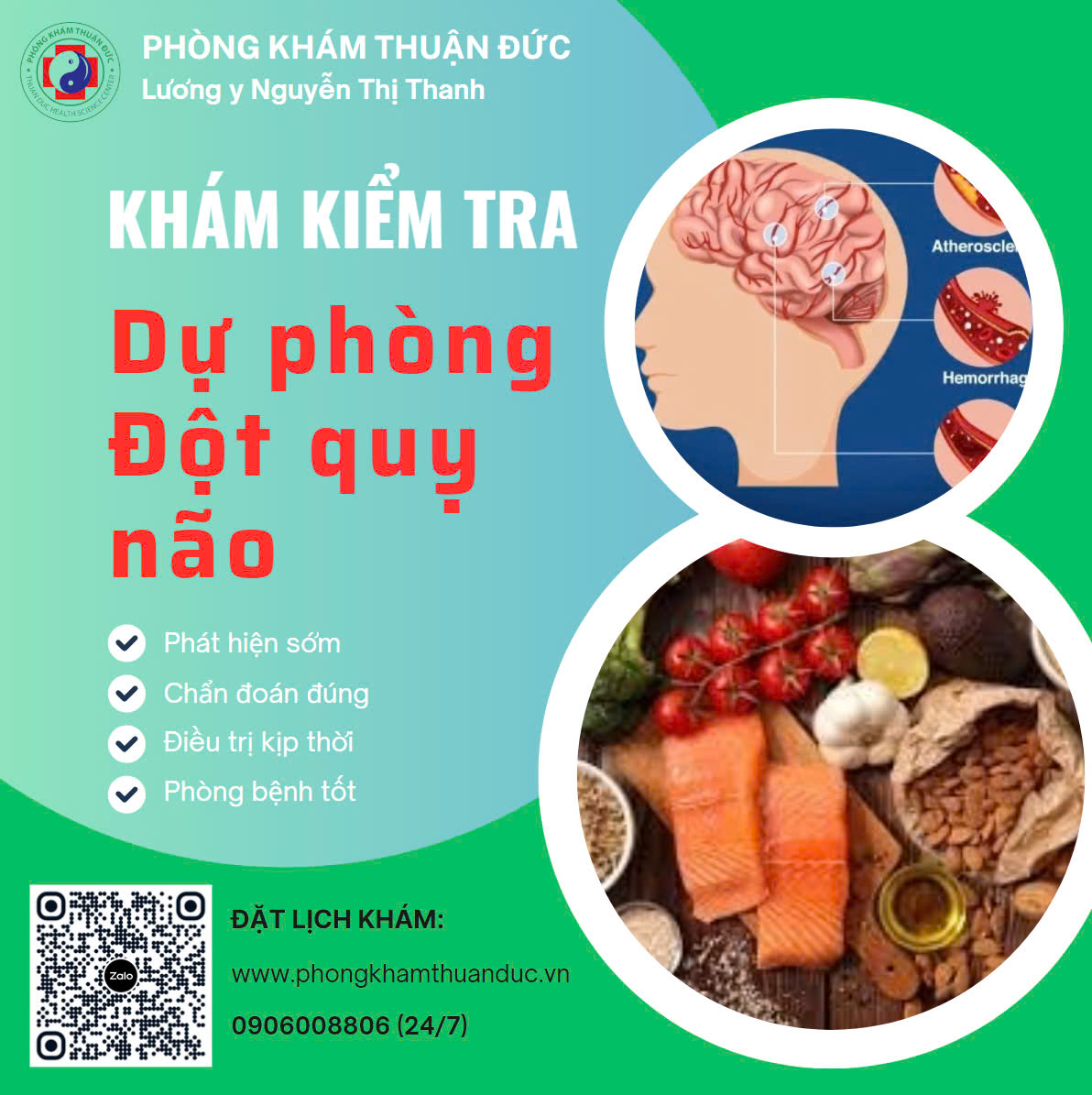 Phát hiện sớm, chẩn đoán, điều trị và dự phòng Đột quỵ não!