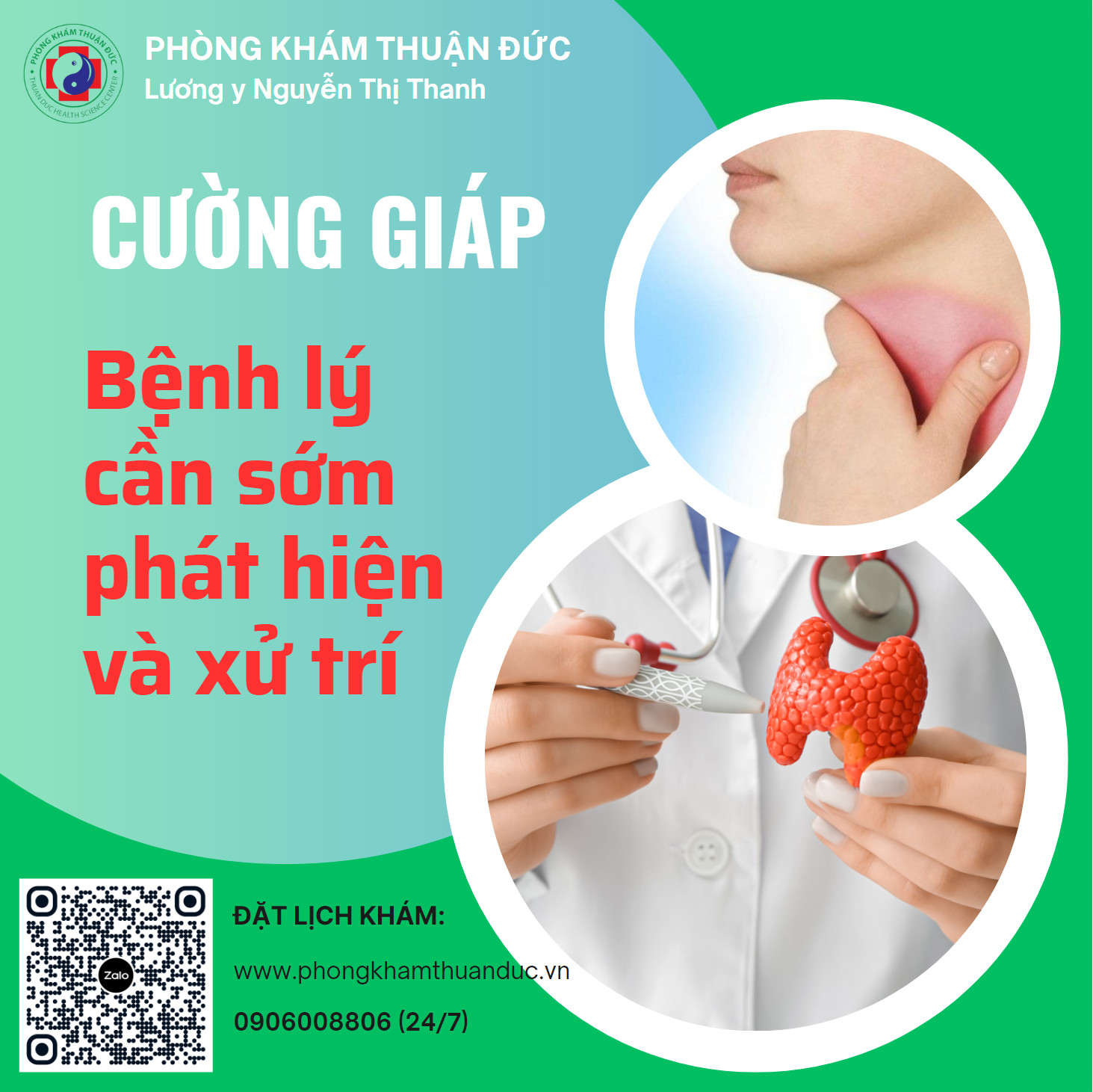 Bệnh cường giáp: Nguyên nhân, triệu chứng, chẩn đoán và xử trí